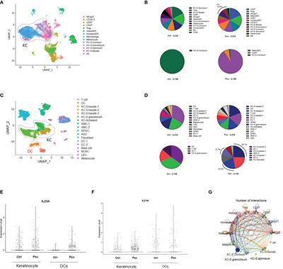 Comparative Analysis of Single-Cell Transcriptome Data Reveals a Novel Role of Keratinocyte-Derived IL-23 in Psoriasis